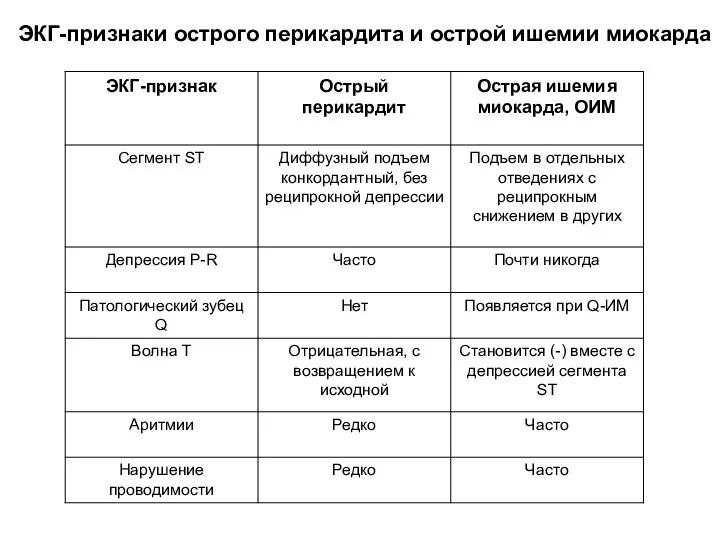 ЭКГ-признаки острого перикардита и острой ишемии миокарда