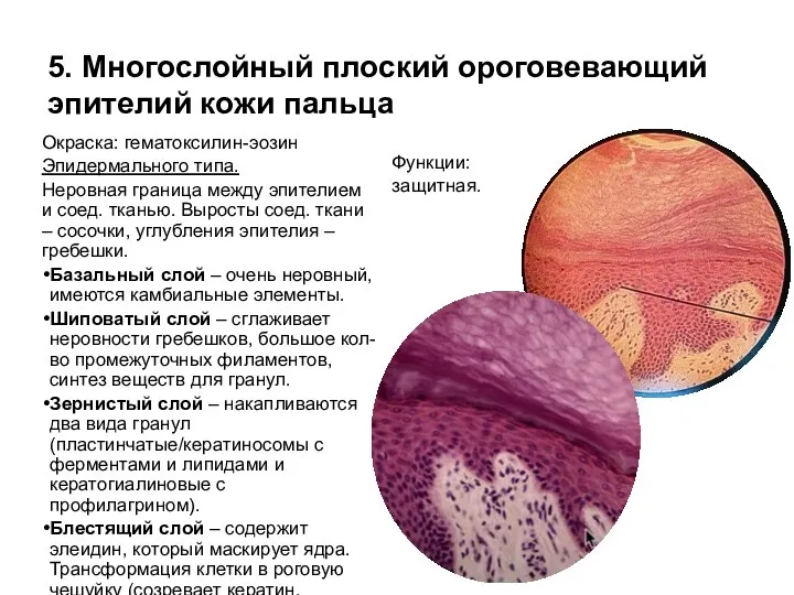 5. Многослойный плоский ороговевающий эпителий кожи пальца Окраска: гематоксилин-эозин Эпидермального типа. Неровная