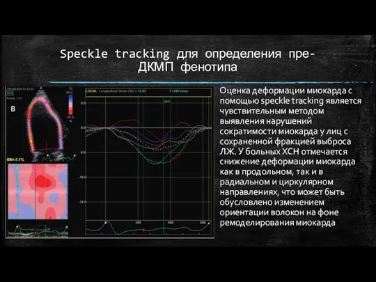 Speckle tracking для определения пре-ДКМП фенотипа Оценка деформации миокарда с помощью speckle