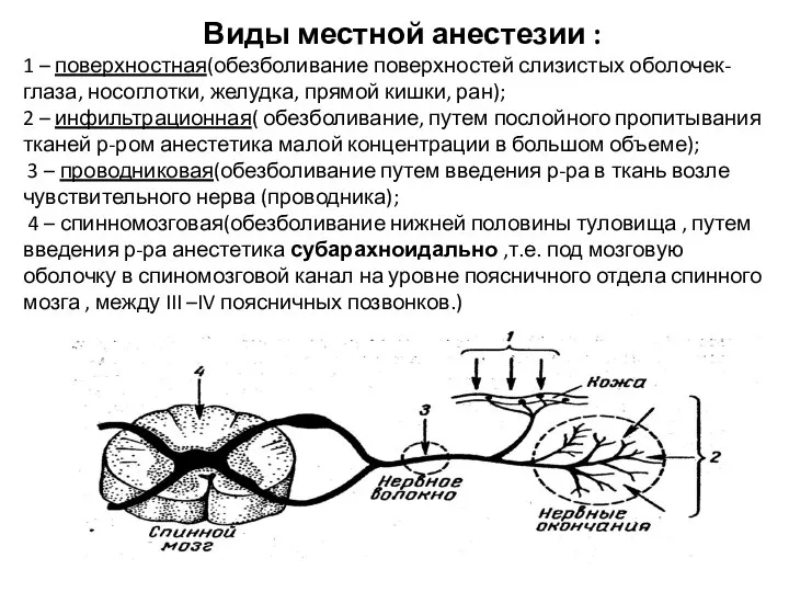 Виды местной анестезии : 1 – поверхностная(обезболивание поверхностей слизистых оболочек- глаза, носоглотки,