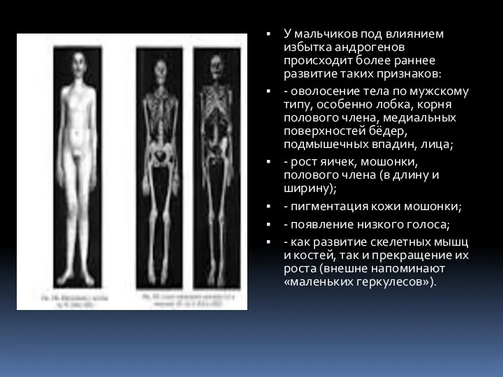 У мальчиков под влиянием избытка андрогенов происходит более раннее развитие таких признаков: