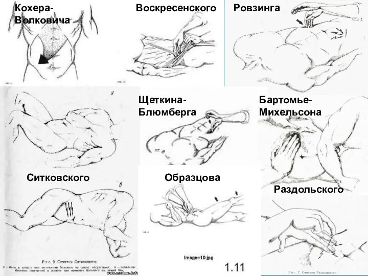 Кохера-Волковича Воскресенского Ровзинга Ситковского Щеткина-Блюмберга Бартомье-Михельсона Образцова Раздольского