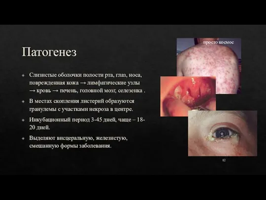Патогенез 12 Слизистые оболочки полости рта, глаз, носа, поврежденная кожа → лимфатические