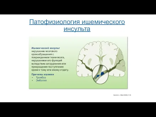 Патофизиология ишемического инсульта Gorelick. J Med 2009;2:1-8. Ишемический инсульт нарушение мозгового кровообращения