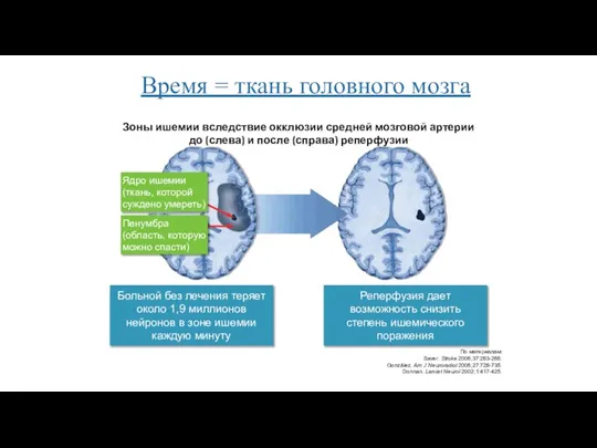 Время = ткань головного мозга По материалам: Saver. Stroke 2006;37:263-266. González. Am