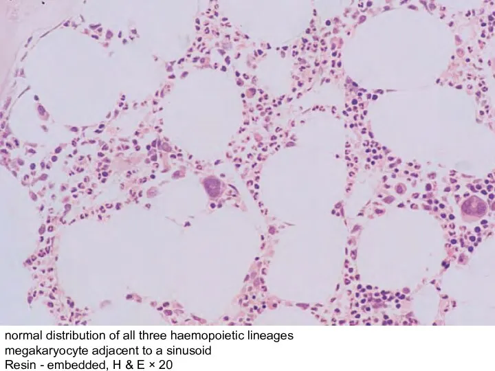 normal distribution of all three haemopoietic lineages megakaryocyte adjacent to a sinusoid