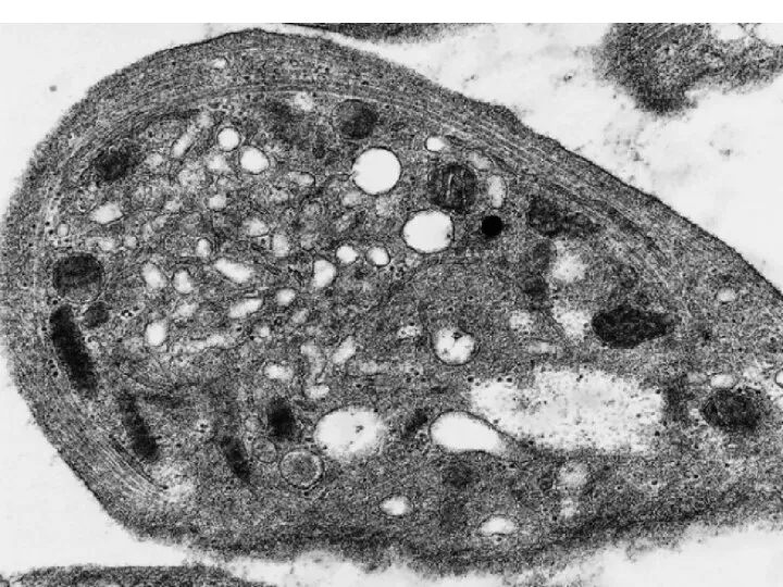 Electron micrograph of a platelet sectioned in the equatorial plane showing the