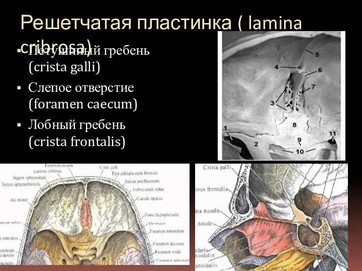 Решетчатая пластинка ( lamina cribrosa) Петушиный гребень (crista galli) Слепое отверстие (foramen