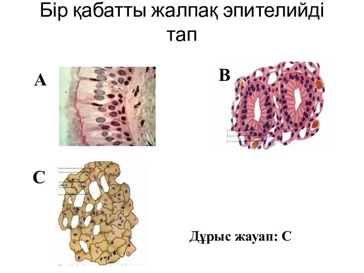 Бір қабатты жалпақ эпителийді тап С В А Дұрыс жауап: С