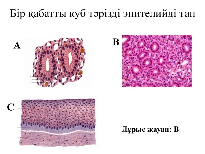 Бір қабатты куб тәрізді эпителийді тап А В С Дұрыс жауап: В
