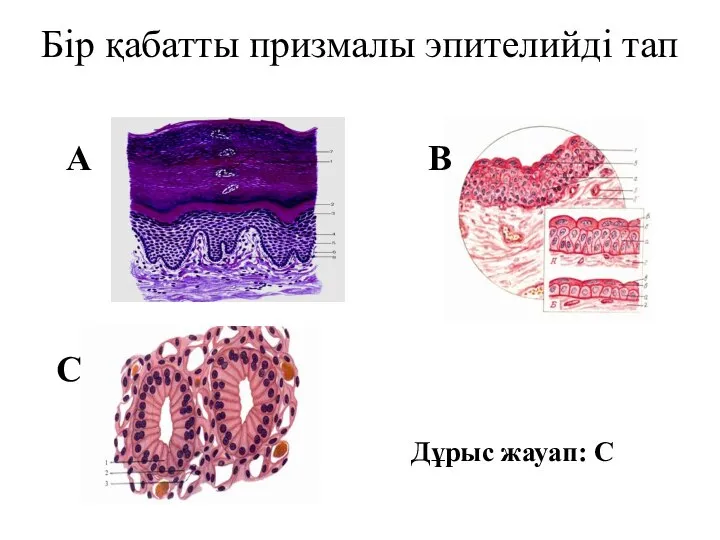 Бір қабатты призмалы эпителийді тап С В А Дұрыс жауап: С