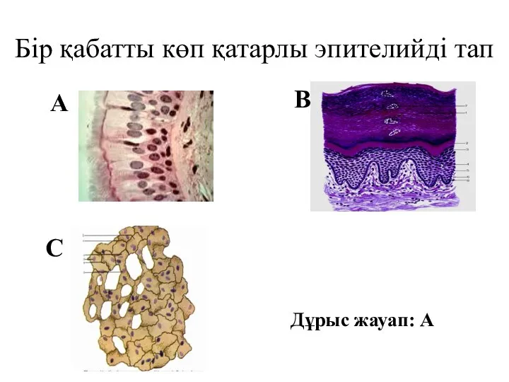 Бір қабатты көп қатарлы эпителийді тап В А С Дұрыс жауап: А