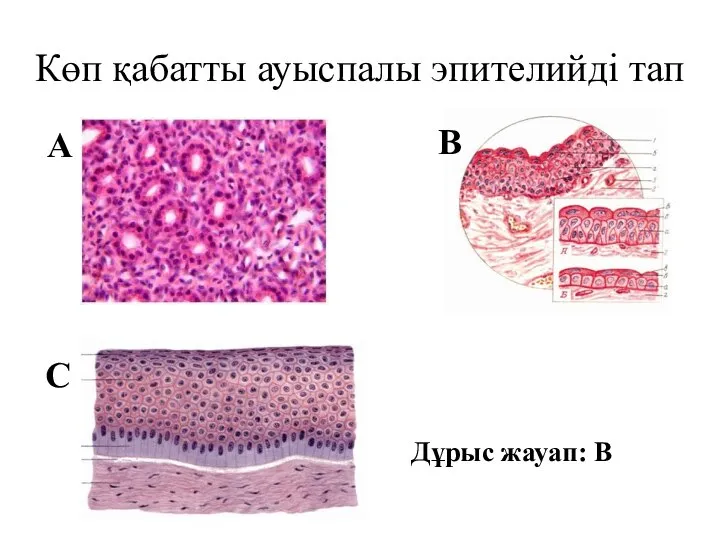 Көп қабатты ауыспалы эпителийді тап В А С Дұрыс жауап: В