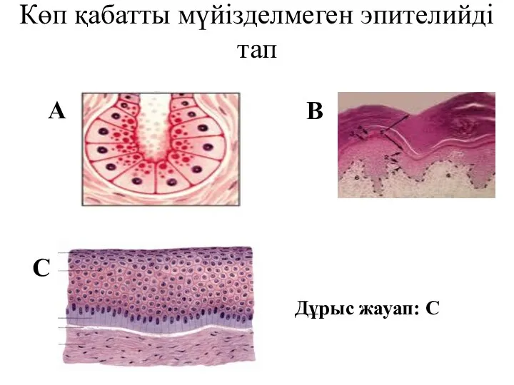 Көп қабатты мүйізделмеген эпителийді тап С А В Дұрыс жауап: С