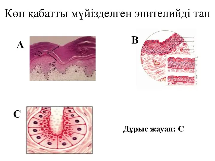 Көп қабатты мүйізделген эпителийді тап А В С Дұрыс жауап: С