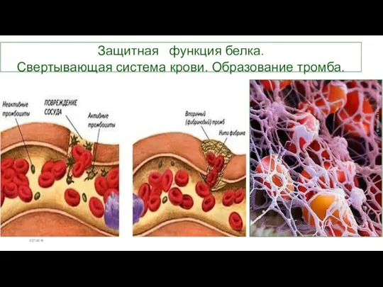 3/27/2018 Защитная функция белка. Свертывающая система крови. Образование тромба.