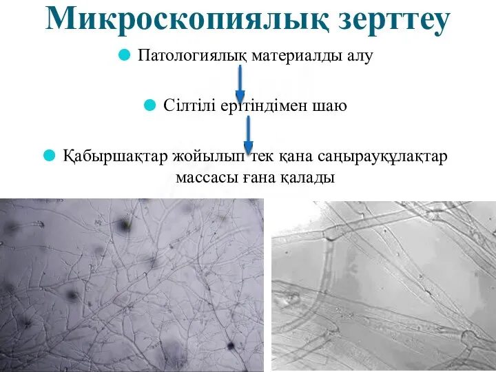 Микроскопиялық зерттеу Патологиялық материалды алу Сілтілі ерітіндімен шаю Қабыршақтар жойылып тек қана саңырауқұлақтар массасы ғана қалады