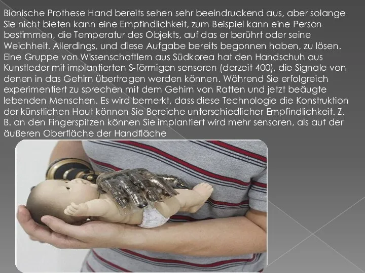 Bionische Prothese Hand bereits sehen sehr beeindruckend aus, aber solange Sie nicht