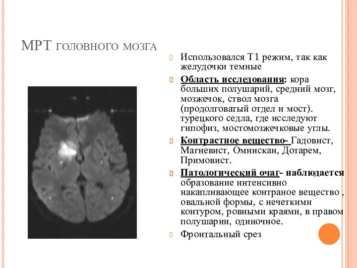 МРТ головного мозга Использовался Т1 режим, так как желудочки темные Область исследования: