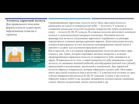 Элементы кариозной полости. Для правильного описания формы полости существуют определенные понятия и