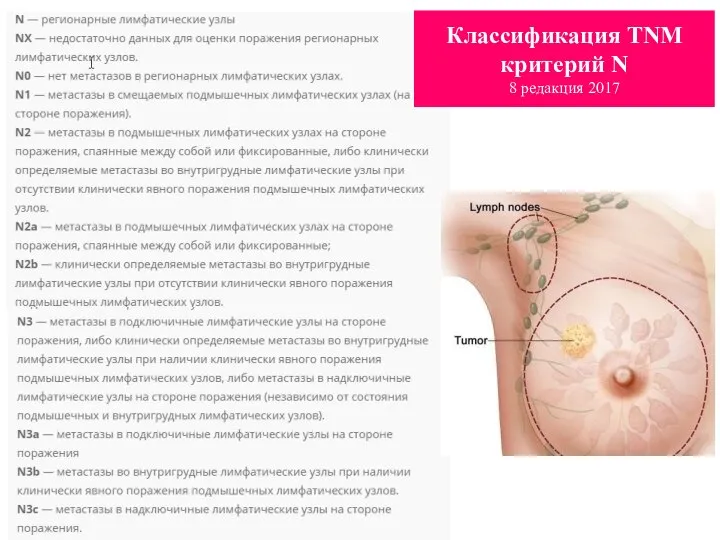 Классификация TNM критерий N 8 редакция 2017