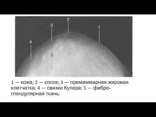 1 — кожа; 2 — сосок; 3 — премаммарная жиро­вая клетчатка; 4