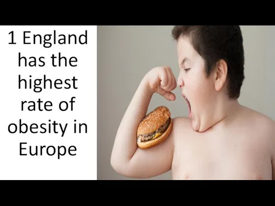 1 England has the highest rate of obesity in Europe