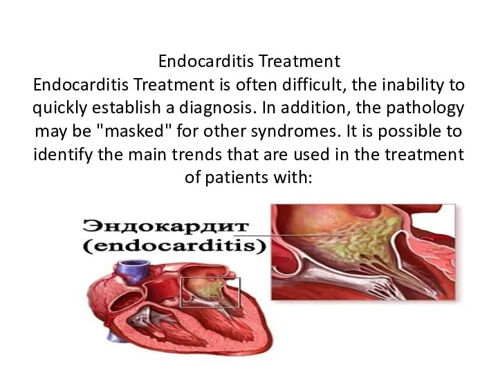 Endocarditis Treatment Endocarditis Treatment is often difficult, the inability to quickly establish