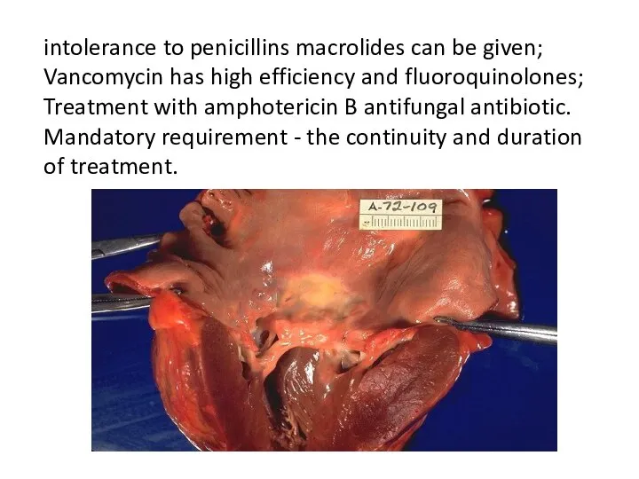 intolerance to penicillins macrolides can be given; Vancomycin has high efficiency and