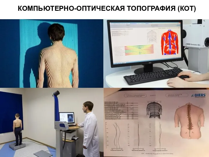 КОМПЬЮТЕРНО-ОПТИЧЕСКАЯ ТОПОГРАФИЯ (КОТ)