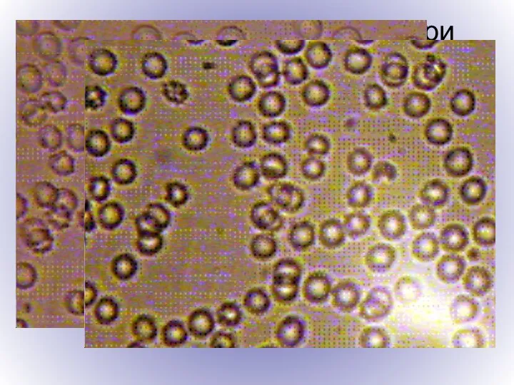Отсутствие агглютинации при микроскопии – кровь совместима