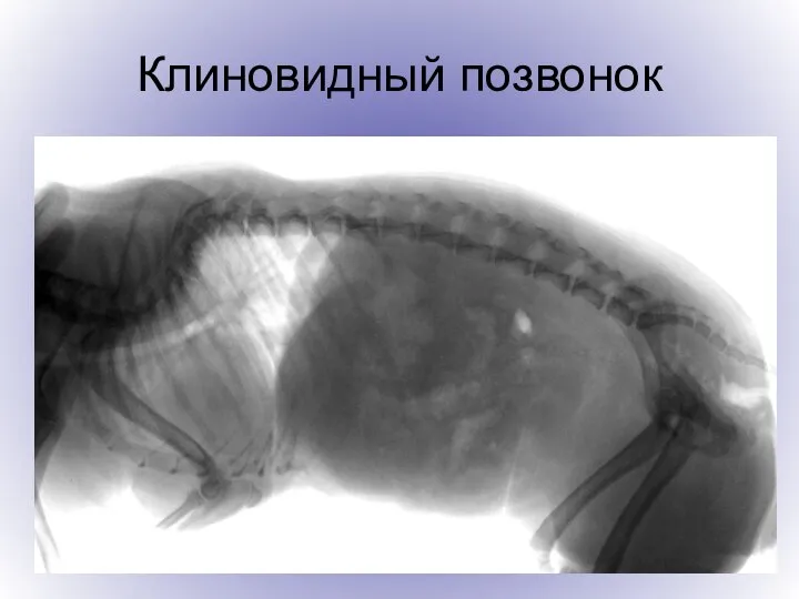 Клиновидный позвонок