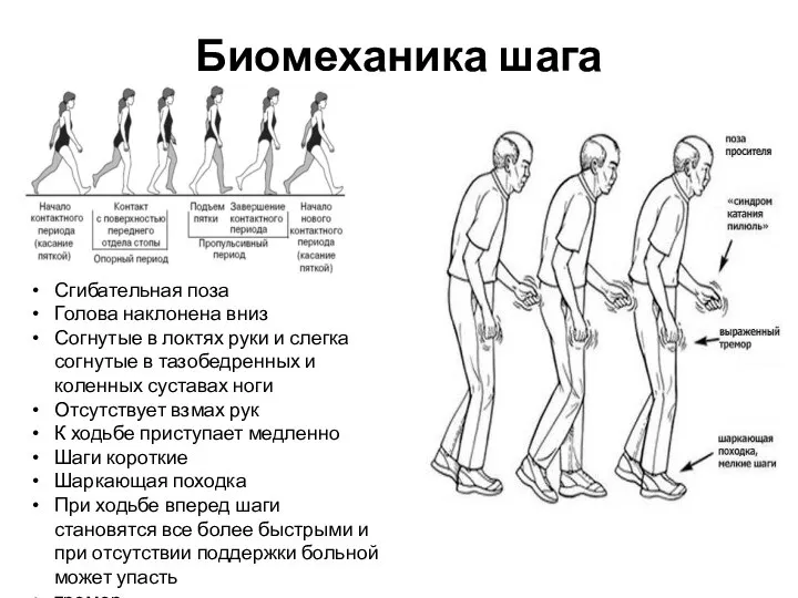 Биомеханика шага Сгибательная поза Голова наклонена вниз Согнутые в локтях руки и