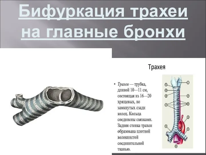 Бифуркация трахеи на главные бронхи