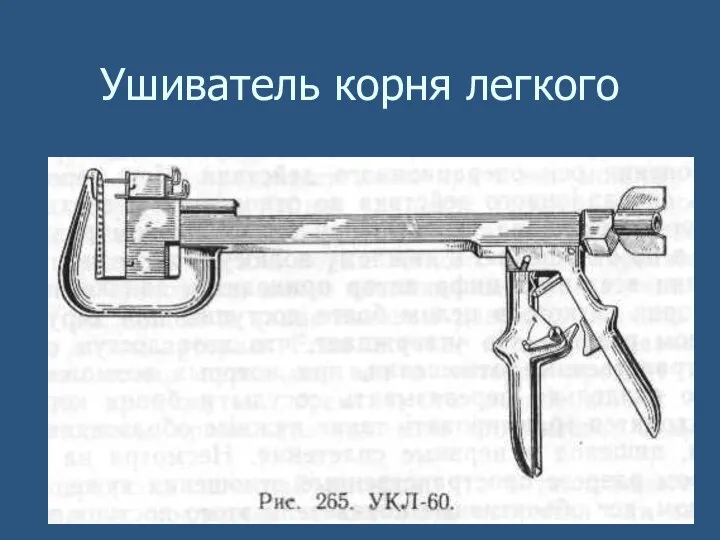 Ушиватель корня легкого