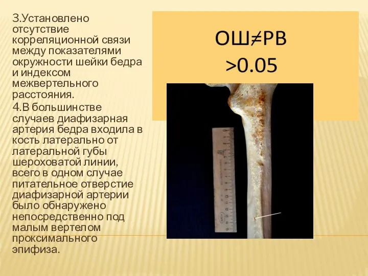 3.Установлено отсутствие корреляционной связи между показателями окружности шейки бедра и индексом межвертельного