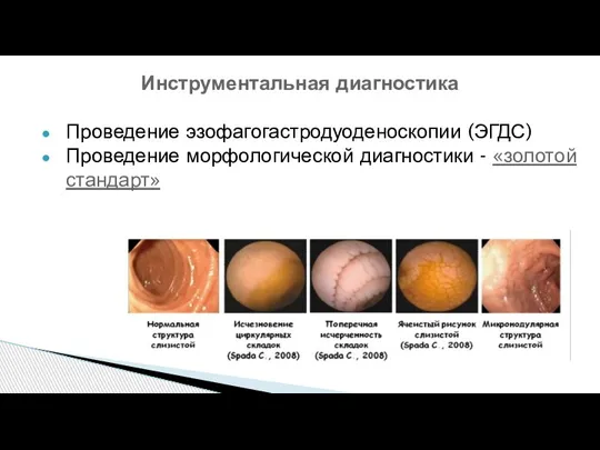 Инструментальная диагностика Проведение эзофагогастродуоденоскопии (ЭГДС) Проведение морфологической диагностики - «золотой стандарт»