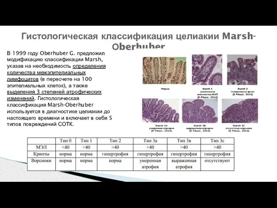 Гистологическая классификация целиакии Marsh-Оberhuber В 1999 году Oberhuber G. предложил модификацию классификации