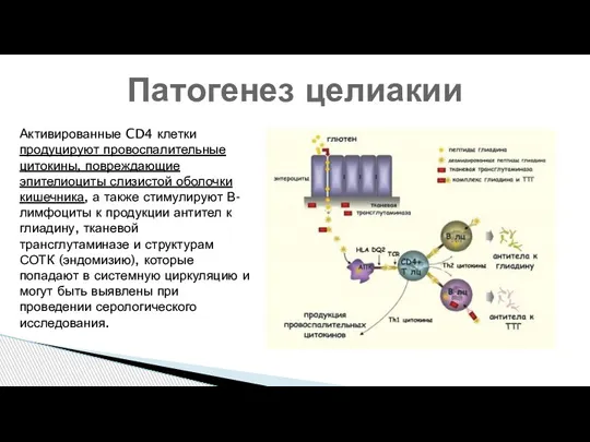 Патогенез целиакии Активированные CD4 клетки продуцируют провоспалительные цитокины, повреждающие эпителиоциты слизистой оболочки