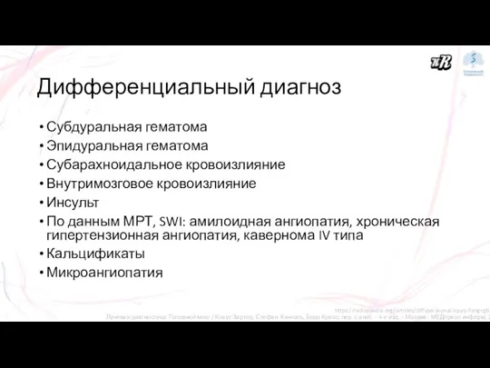 Дифференциальный диагноз Субдуральная гематома Эпидуральная гематома Субарахноидальное кровоизлияние Внутримозговое кровоизлияние Инсульт По