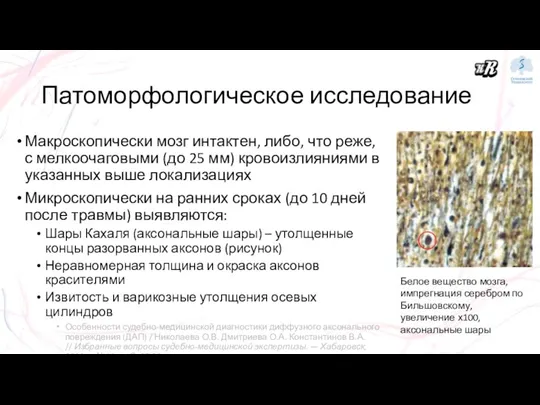 Патоморфологическое исследование Макроскопически мозг интактен, либо, что реже, с мелкоочаговыми (до 25