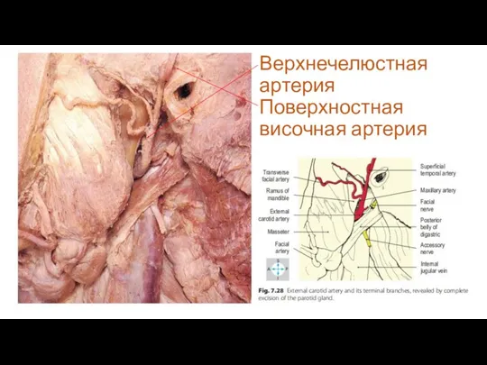 Верхнечелюстная артерия Поверхностная височная артерия