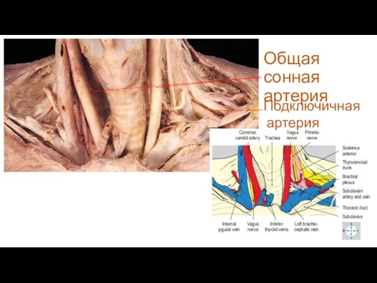 Общая сонная артерия Подключичная артерия