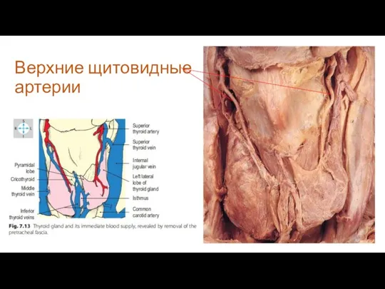 Верхние щитовидные артерии