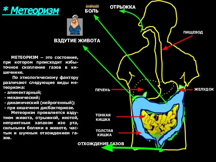 ПИЩЕВОД ЖЕЛУДОК ПЕЧЕНЬ ТОНКАЯ КИШКА ТОЛСТАЯ КИШКА * Метеоризм МЕТЕОРИЗМ – это