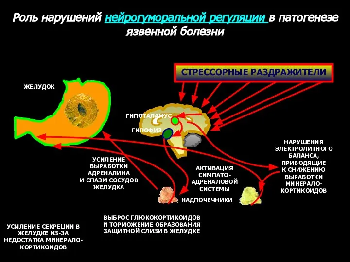 СТРЕССОРНЫЕ РАЗДРАЖИТЕЛИ Роль нарушений нейрогуморальной регуляции в патогенезе язвенной болезни ГИПОТАЛАМУС ГИПОФИЗ