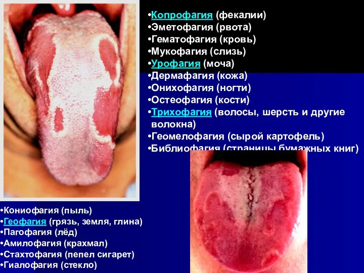 Копрофагия (фекалии) Эметофагия (рвота) Гематофагия (кровь) Мукофагия (слизь) Урофагия (моча) Дермафагия (кожа)