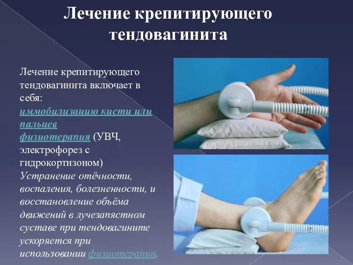 Лечение крепитирующего тендовагинита включает в себя: иммобилизацию кисти или пальцев физиотерапия (УВЧ,