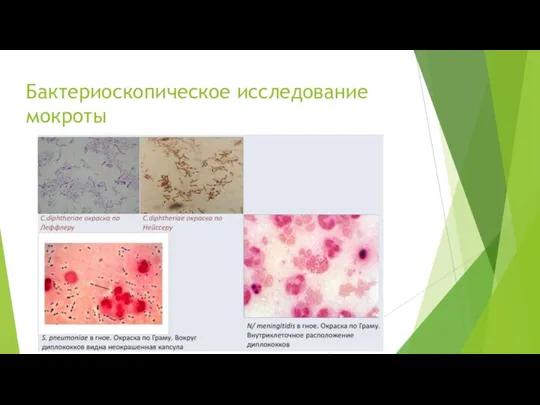 Бактериоскопическое исследование мокроты