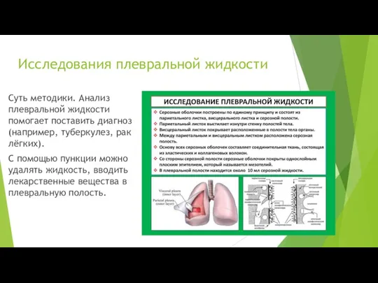 Исследования плевральной жидкости Суть методики. Анализ плевральной жидкости помогает поставить диагноз (например,